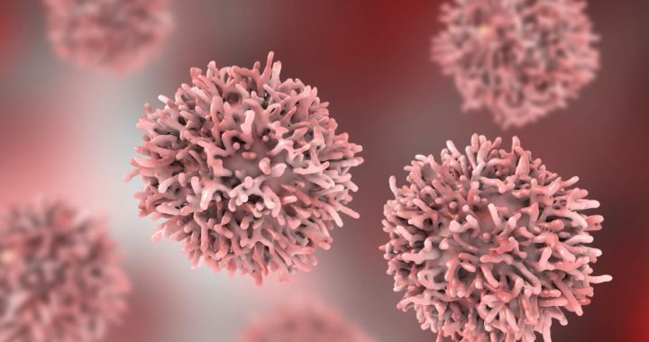 Chemotherapie: Heilung oder Risikofaktor?